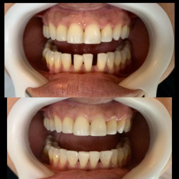 Resultado Dental Concept 5